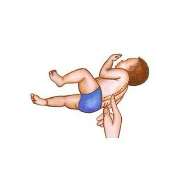 بازتاب های اوليه در كودک